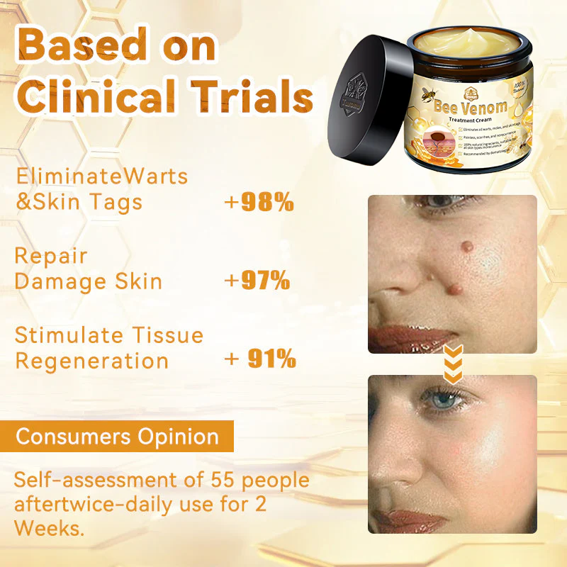 ✨✨Turonu™ Bee Venom Skin Treatment Cream(𝐴𝐴𝐷 𝑅𝑒𝑐𝑜𝑚𝑚𝑒𝑛𝑑𝑒𝑑)