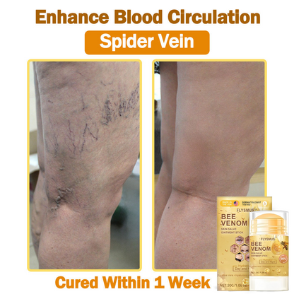 ❤️💞Flysmus™ Bee Venom Skin Salve Ointment Stick 𝐔𝐒 𝐃𝐞𝐫𝐦𝐚𝐭𝐨𝐥𝐨𝐠𝐢𝐬𝐭 𝐀𝐩𝐩𝐫𝐨𝐯𝐞𝐝(💞💞𝐀𝐀𝐃 𝐑𝐄𝐂𝐎𝐌𝐌𝐄𝐍𝐃𝐒)