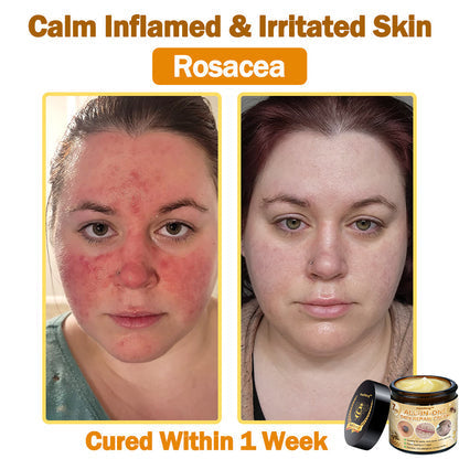 [Official Brand Store] ✨Flysmus™ Bee Venom All-in-One Cream USA Dermatologist Approved (👩‍⚕️FDA Recommended)