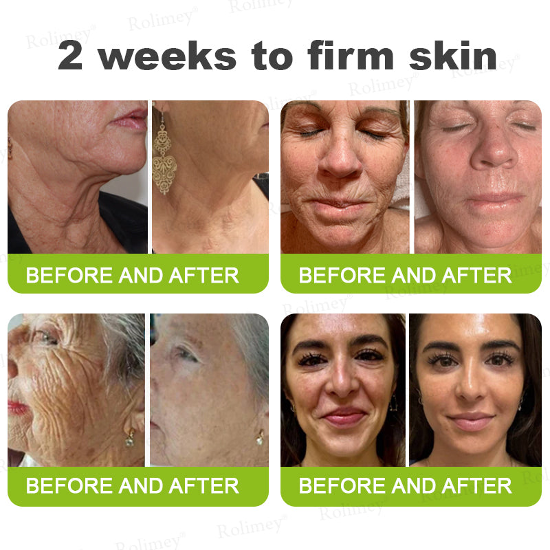 🔥Made and shipped from the CA 💫Rolimey® Botox & Vita-A Retinol Shot Wrinkle-Lift Tightening cream - Last Day Promotion 70% OFF