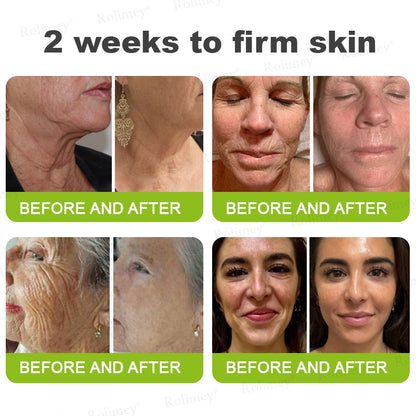🔥Made and shipped from the CA 💫Rolimey® Botox & Vita-A Retinol Shot Wrinkle-Lift Tightening cream - Last Day Promotion 70% OFF