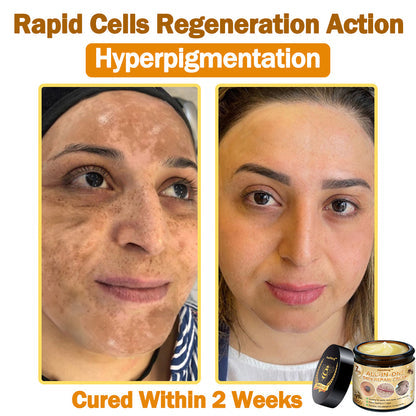 [Official Brand Store] ✨Flysmus™ Bee Venom All-in-One Cream USA Dermatologist Approved (👩‍⚕️FDA Recommended)