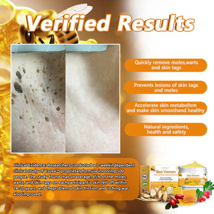 ✨Flysmus™ Bee Venom Wart and Moles Removal Cream (Last day offer, 80% discount)