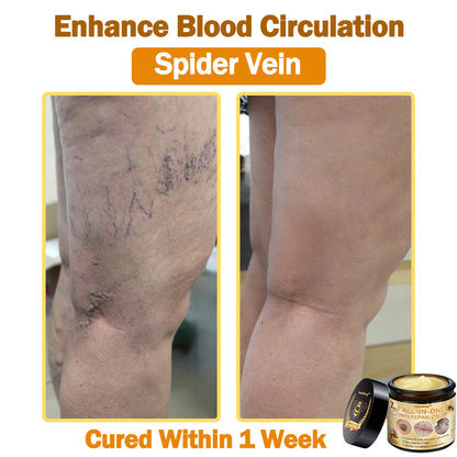 [Official Brand Store] ✨Flysmus™ Bee Venom All-in-One Cream USA Dermatologist Approved (👩‍⚕️FDA Recommended)