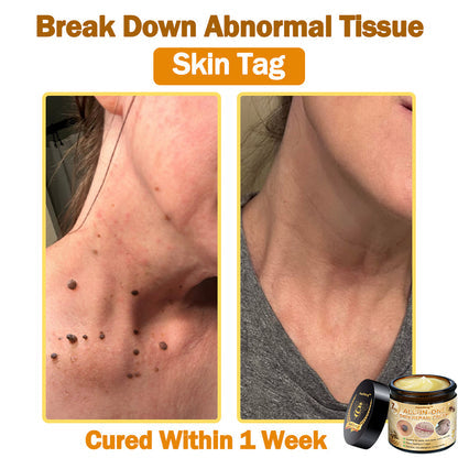 [Official Brand Store] ✨Flysmus™ Bee Venom All-in-One Cream USA Dermatologist Approved (👩‍⚕️FDA Recommended)