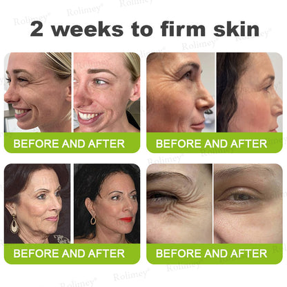 🔥Made and shipped from the CA 💫Rolimey® Botox & Vita-A Retinol Shot Wrinkle-Lift Tightening cream - Last Day Promotion 70% OFF