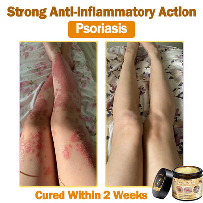 [Official Brand Store] ✨Flysmus™ Bee Venom All-in-One Cream USA Dermatologist Approved (👩‍⚕️FDA Recommended)