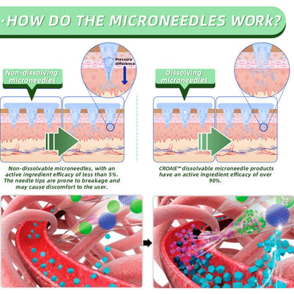 👩‍⚕️Croaie™ SMGT-GLP-1 Nano Microneedle Patch✨（Painless, long-lasting, addressing diabetes, obesity, and cardiovascular diseases）