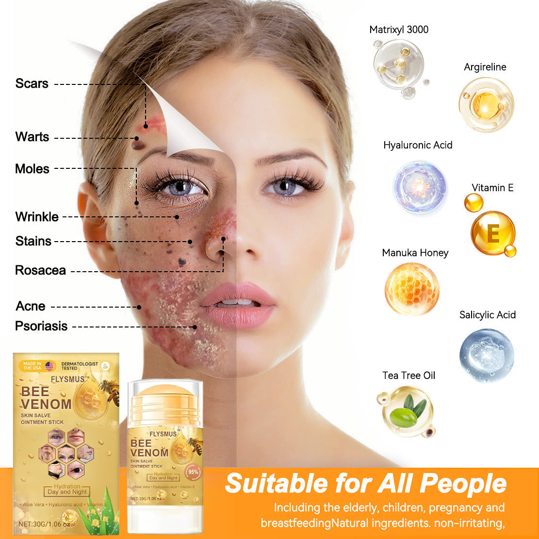 ❤️💞Flysmus™ Bee Venom Skin Salve Ointment Stick 𝐔𝐒 𝐃𝐞𝐫𝐦𝐚𝐭𝐨𝐥𝐨𝐠𝐢𝐬𝐭 𝐀𝐩𝐩𝐫𝐨𝐯𝐞𝐝(💞💞𝐀𝐀𝐃 𝐑𝐄𝐂𝐎𝐌𝐌𝐄𝐍𝐃𝐒)