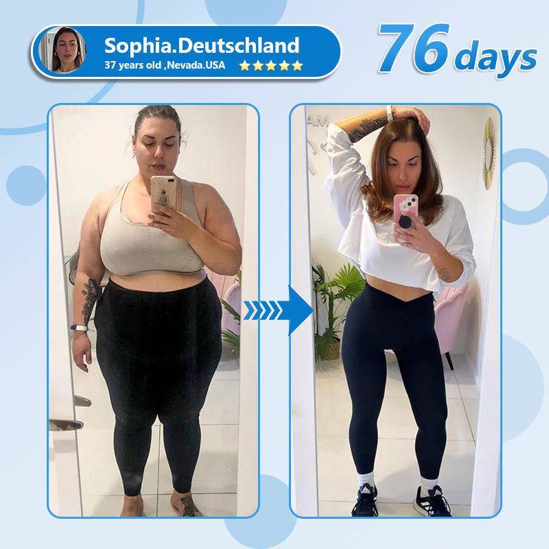 💫[7 Days to See Yourself Differently]Flysmus® 🎁 Nano Microneedle Patch with SMGT-GLP-1 & Matrixyl 3000 – Slimming, Skin Tightening, Blood Sugar Support, No Injection, 7-Day Result🌍