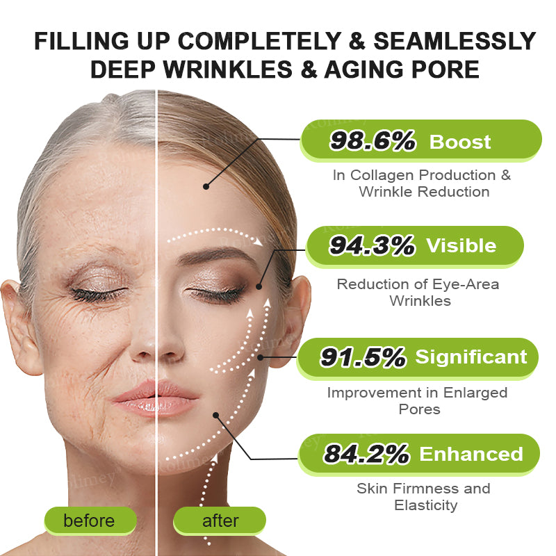 🔥Made and shipped from the CA 💫Rolimey® Botox & Vita-A Retinol Shot Wrinkle-Lift Tightening cream - Last Day Promotion 70% OFF