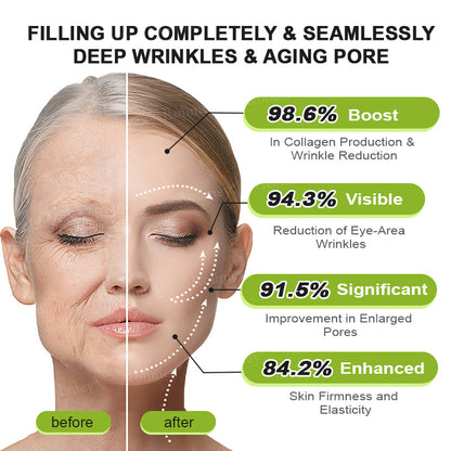 🔥Made and shipped from the CA 💫Rolimey® Botox & Vita-A Retinol Shot Wrinkle-Lift Tightening cream - Last Day Promotion 70% OFF