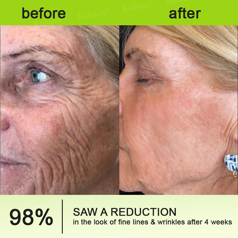 🔥Made and shipped from the CA 💫Rolimey® Botox & Vita-A Retinol Shot Wrinkle-Lift Tightening cream - Last Day Promotion 70% OFF