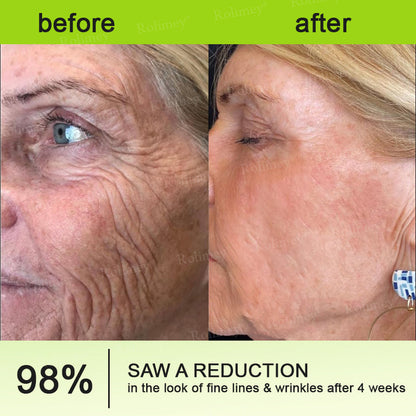 🔥Made and shipped from the CA 💫Rolimey® Botox & Vita-A Retinol Shot Wrinkle-Lift Tightening cream - Last Day Promotion 70% OFF