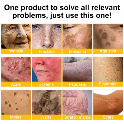 ⚡🧑‍⚕️Rolimey® Bee venom Pro Comprehensive Cream — 🔥Limited Time 80% OFF🔥