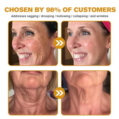 ⚡🧑‍⚕️Rolimey® Bee venom Pro Comprehensive Cream — 🔥Limited Time 80% OFF🔥