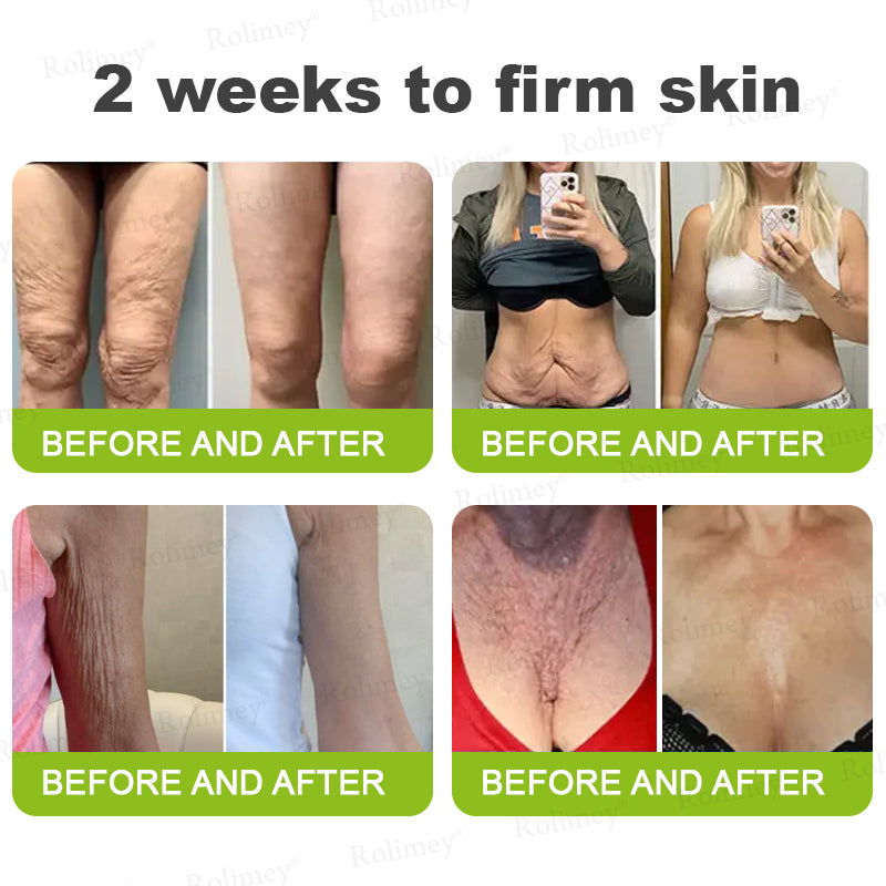 🔥Made and shipped from the CA 💫Rolimey® Botox & Vita-A Retinol Shot Wrinkle-Lift Tightening cream - Last Day Promotion 70% OFF