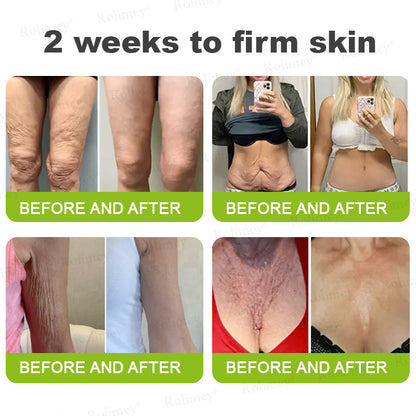 🔥Made and shipped from the CA 💫Rolimey® Botox & Vita-A Retinol Shot Wrinkle-Lift Tightening cream - Last Day Promotion 70% OFF