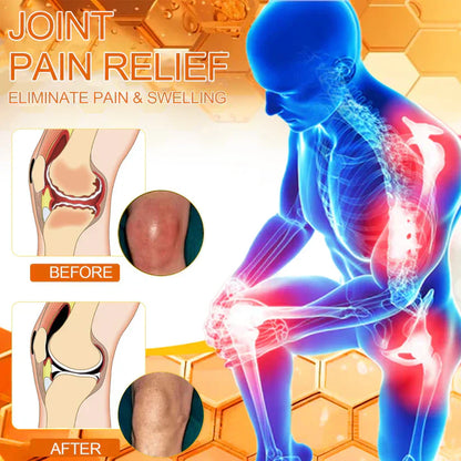 ✅Official Store: Ourlyard™ Magnesium Oil & Bee Venom Joint Healing Spray👨‍⚕️USA Osteopathic Medical Association （AAOS）Approved