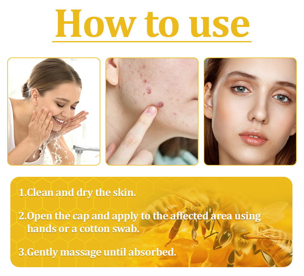 🌟👍Official Store: Flysmus™ Bee Venom Skin Treatment Cream👨‍⚕️American Academy of Dermatology (AAD) Approved.