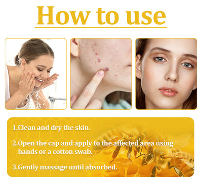 🌟👍Official Store: Flysmus™ Bee Venom Skin Treatment Cream👨‍⚕️American Academy of Dermatology (AAD) Approved.