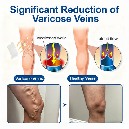 🇨🇦👨‍⚕️🔥GFOUK® VeinEase Microneedle Care Patch⚡Instant Relief, Long-Term Results