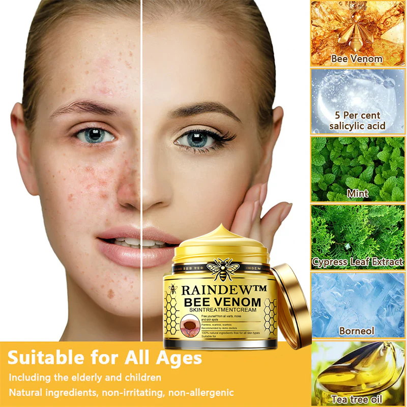 ✅ Official Store: [Winter-Skincare] Flysmus™ Bee Venom Skin Treatment Cream（Meets AAD Standards）🧑‍⚕️