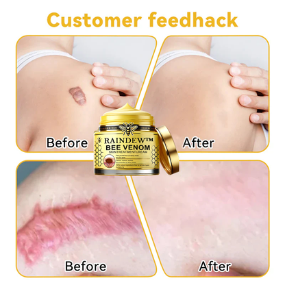 ✅ Official Store: [Winter-Skincare] Flysmus™ Bee Venom Skin Treatment Cream（Meets AAD Standards）🧑‍⚕️