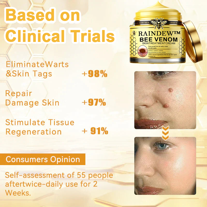 ✅ Official Store: [Winter-Skincare] Flysmus™ Bee Venom Skin Treatment Cream（Meets AAD Standards）🧑‍⚕️