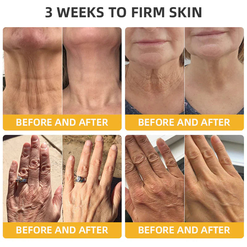 ✅ Official Store:🔥Bee Venom Retinol Skin Salve Ointment 🐝 AAD Recommended (🔥 55% Off for a Limited Time in the USA!)