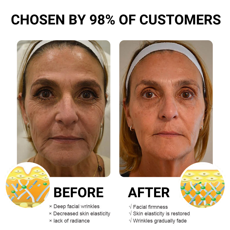 (🍇Made and Shipped from Australia✅) Flysmus™ Retinol Correxion Deep Wrinkle Retinol Face Serum