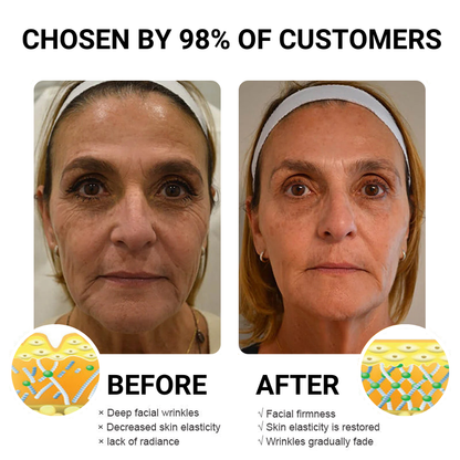 (🍇Made and Shipped from Australia✅) Flysmus™ Retinol Correxion Deep Wrinkle Retinol Face Serum