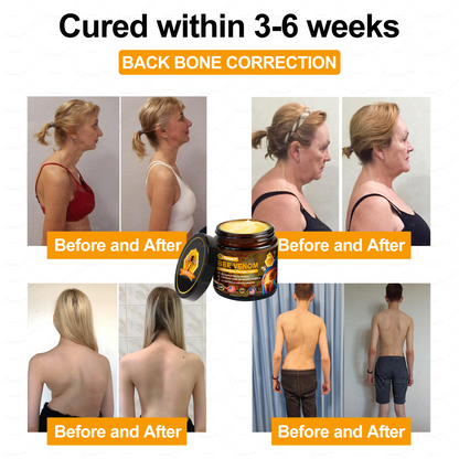 ✅ Official Store: Bee-Venom Pain-Relief Bone Healing Cream ✅ (FDA Approved) (🔥 Last Day Promotion - 80% OFF ) 🍀
