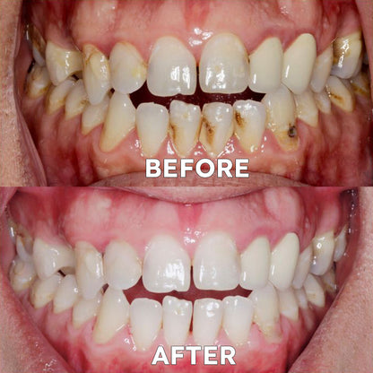 Official Store | ✨Ourlyard™ Tooth Health Mineral Powder - ✅FDA-Approved