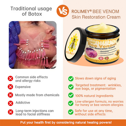 ⚡🧑‍⚕️Rolimey® Bee venom Pro Comprehensive Cream — 🔥Limited Time 80% OFF🔥