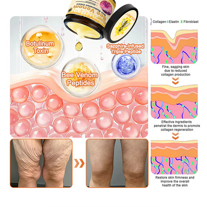 ⚡🧑‍⚕️Rolimey® Bee venom Pro Comprehensive Cream — 🔥Limited Time 80% OFF🔥