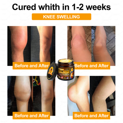 ✅ Official Store: Bee-Venom Pain-Relief Bone Healing Cream ✅ (FDA Approved) (🔥 Last Day Promotion - 80% OFF ) 🍀