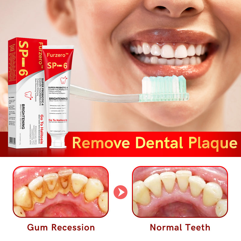 Furzero™ Aussie SP-6 Probiotic Ultra Whitening Toothpaste🦷👨‍⚕️Recommendation