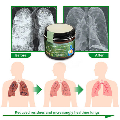👑Official Store:Lercea™ 👑Mullein Clear Lung Repair Cream - endorsed by the British Thoracic Society to support lung health🎉🎉