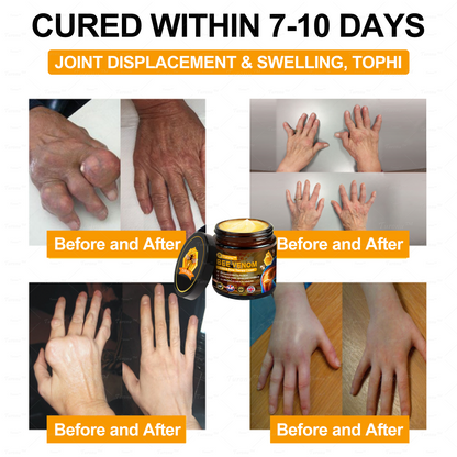 ✅ Official Store: Bee-Venom Pain-Relief Bone Healing Cream ✅ (FDA Approved) (🔥 Last Day Promotion - 80% OFF ) 🍀