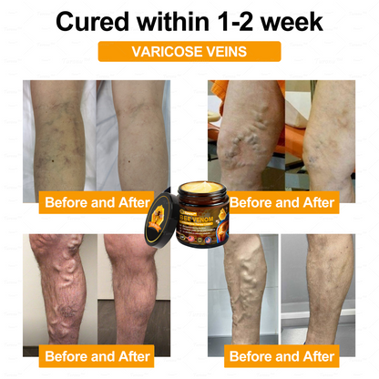 ✅ Official Store: Bee-Venom Pain-Relief Bone Healing Cream ✅ (FDA Approved) (🔥 Last Day Promotion - 80% OFF ) 🍀