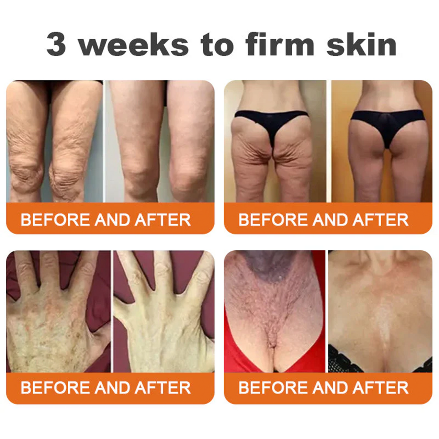⚡🧑‍⚕️Rolimey® Bee venom Pro Comprehensive Cream — 🔥Limited Time 80% OFF🔥