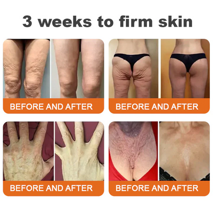 ⚡🧑‍⚕️Rolimey® Bee venom Pro Comprehensive Cream — 🔥Limited Time 80% OFF🔥