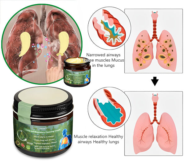 👑Official Store:Lercea™ 👑Mullein Clear Lung Repair Cream - endorsed by the British Thoracic Society to support lung health🎉🎉