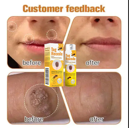 ✨𝐋𝐚𝐬𝐭 𝐃𝐚𝐲 𝐃𝐢𝐬𝐜𝐨𝐮𝐧𝐭: 87% 𝐎𝐅𝐅 🐝Flysmus™ TagRecede Bees  Treatment Spray