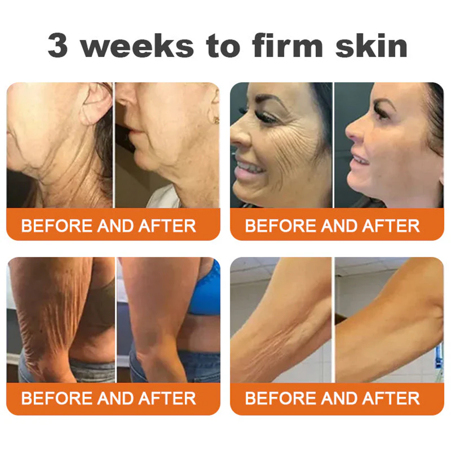 ⚡🧑‍⚕️Rolimey® Bee venom Pro Comprehensive Cream — 🔥Limited Time 80% OFF🔥