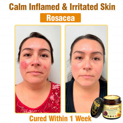 ✅ Official Store: Flysmus™ Bee Venom Comprehensive Cream 🎉🎉 (Suitable for all ages & FDA Recommended)