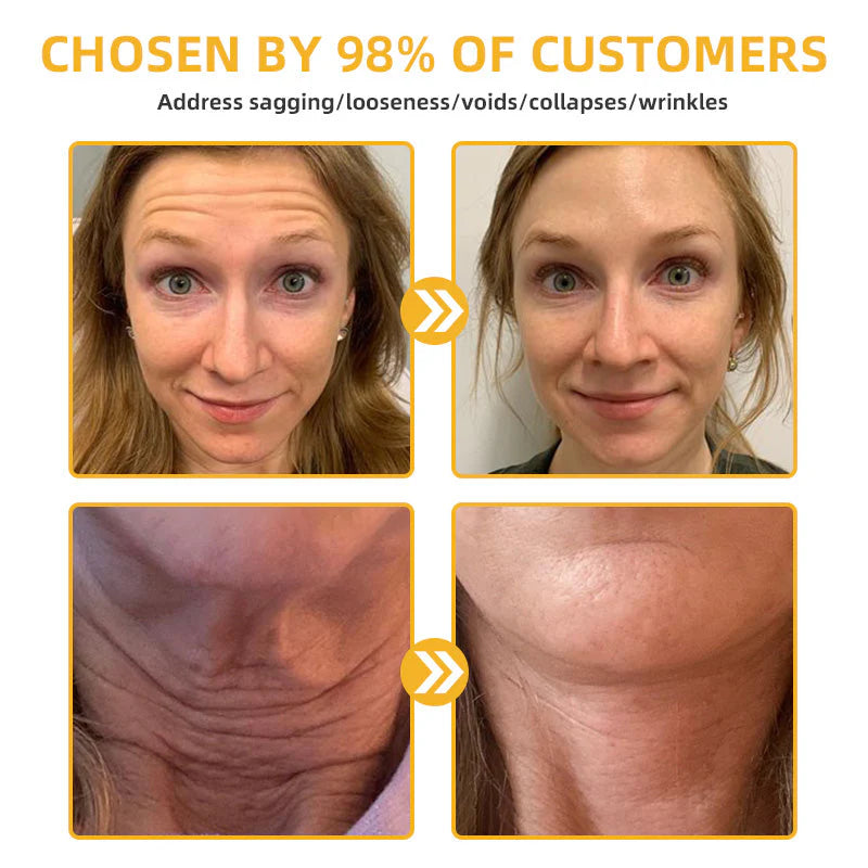✅ Official Store:🔥Bee Venom Retinol Skin Salve Ointment 🐝 AAD Recommended (🔥 55% Off for a Limited Time in the USA!)