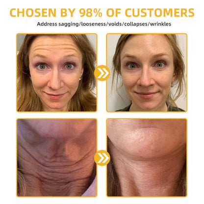 ✅ Official Store:🔥Bee Venom Retinol Skin Salve Ointment 🐝 AAD Recommended (🔥 55% Off for a Limited Time in the USA!)