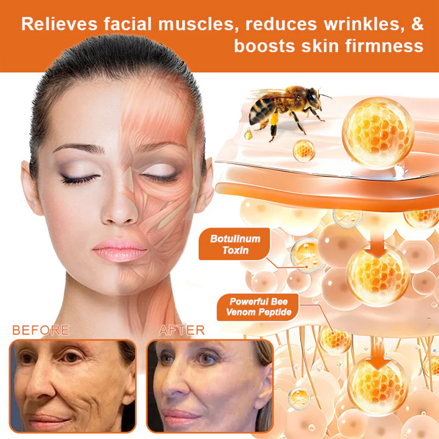 ⚡🧑‍⚕️Rolimey® Bee venom Pro Comprehensive Cream — 🔥Limited Time 80% OFF🔥
